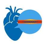 Cardiac Catheterization